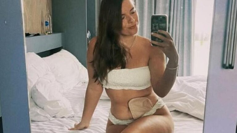 Living Life to the Fullest: My Journey with an Ostomy Bag