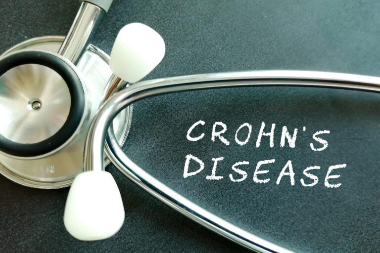 Crohn’s Disease: Essential Facts You Should Know