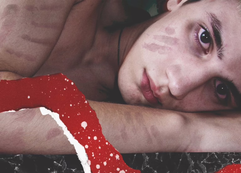 Love and Pain: Women Share Their Stories of Domestic Abuse