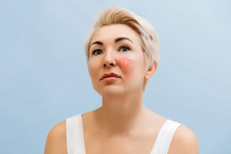 8 Science-Backed Ways to Calm Skin Inflammation & Restore Your Glow