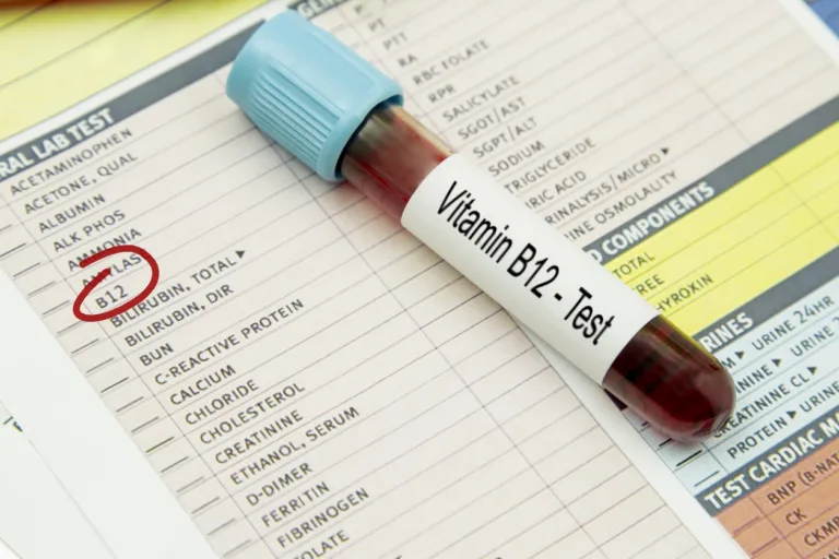 Vitamin B12 Deficiency: Causes, Symptoms, and Solutions