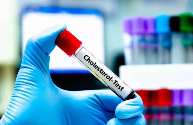 The Hidden Connection Between Cholesterol and Dementia: How Statins Could Be Your Brain’s Best Friend