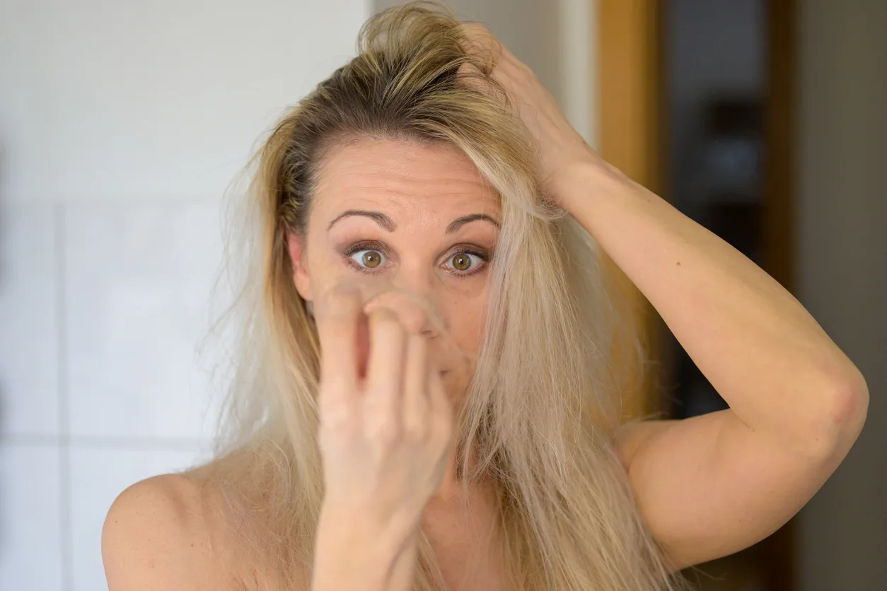 Thinning Hair