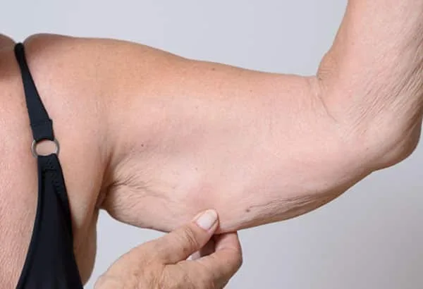 Beat the Loose Skin Battle: Secrets to a Firmer You in Your 50s and Beyond